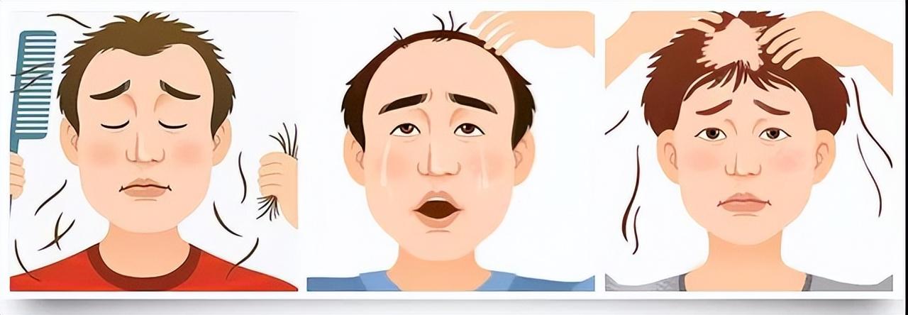 生发最新进展,生发最新进展,探索前沿科技与未来治疗策略