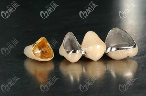 全瓷牙的价格之旅,探寻微笑密码的旅程