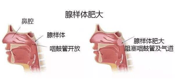 耳鼻喉领域最新进展与变革回眸，探索最新动态与未来趋势