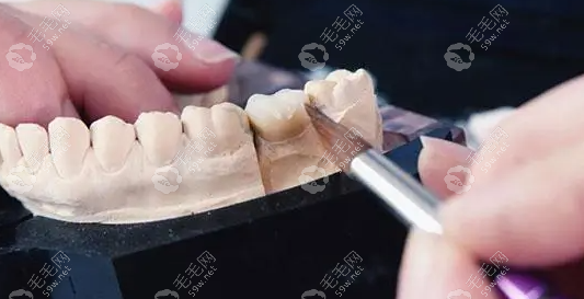 牙齿再生技术揭秘，最新进展与一颗牙的奇妙旅程与友情故事