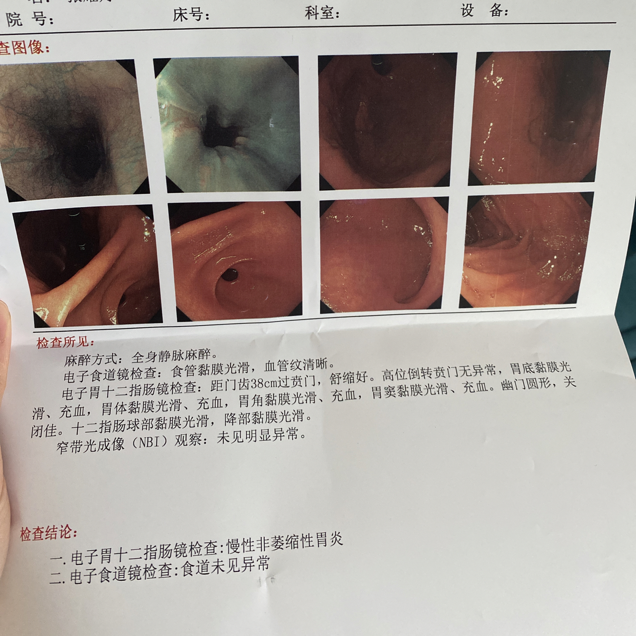 探索消化世界的神奇之旅，最新胃镜技术开启健康成就之门