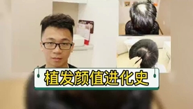 最新植发之旅，与自然美景同行，探寻内心平和的绿洲